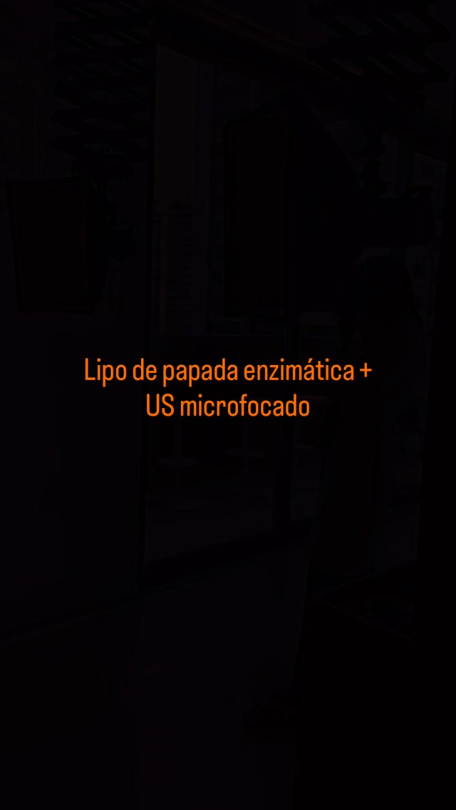 Lipo de papada enzimática + US microfocado

Contorno facial não se trata apenas de reduzir volume. Trata-se de ente...
